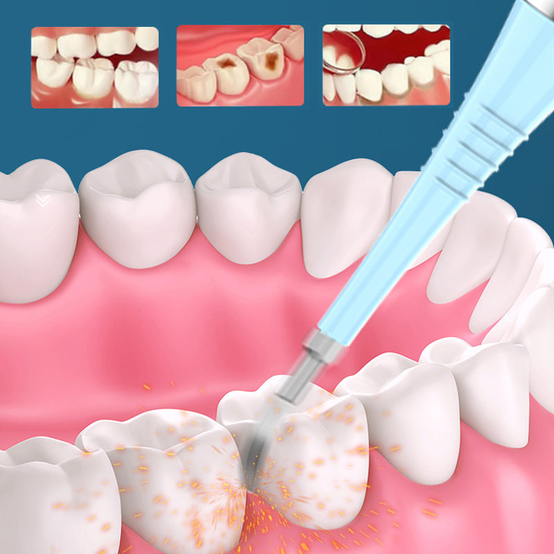 Electric Dental Scaler Dental Calculus Remover